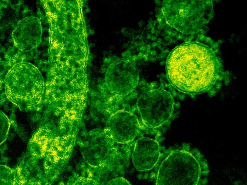 microscopic shot of a virus